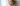 Procedură lifting facial 3D HIFU SMAS realizată în clinică estetică din Moldova
