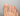 la micosi - Nailssecrets