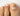 un’infezione causata da funghi - Nailssecrets