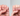 macchia sospetta sull’unghia - Nailssecrets