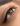 Permanent eyeliner enhancement treatment